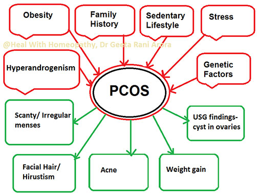 PCOS/Polycystic Ovarian Syndrome
